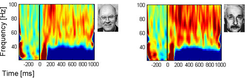 Gamma activity