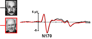 N170